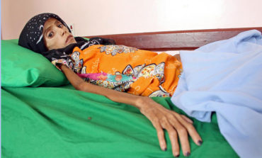 Starving girl shows impact of Yemen war, economic collapse