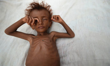 The war in Yemen must end, as famine spreads