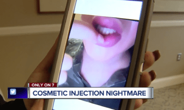 Woman's lips injected with non-FDA approved product at Dearborn Heights salon